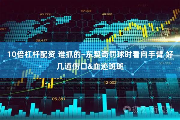 10倍杠杆配资 谁抓的~东契奇罚球时看向手臂 好几道伤口&血迹斑斑